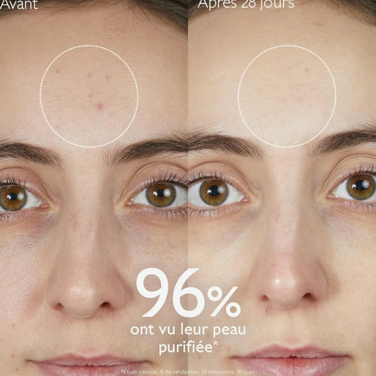 CAUDALIE Peaux À Tendance Acnéique|Démaquillants & Nettoyants^Gelée Nettoyante à l'Acide Salicylique Purifiante - 385mL