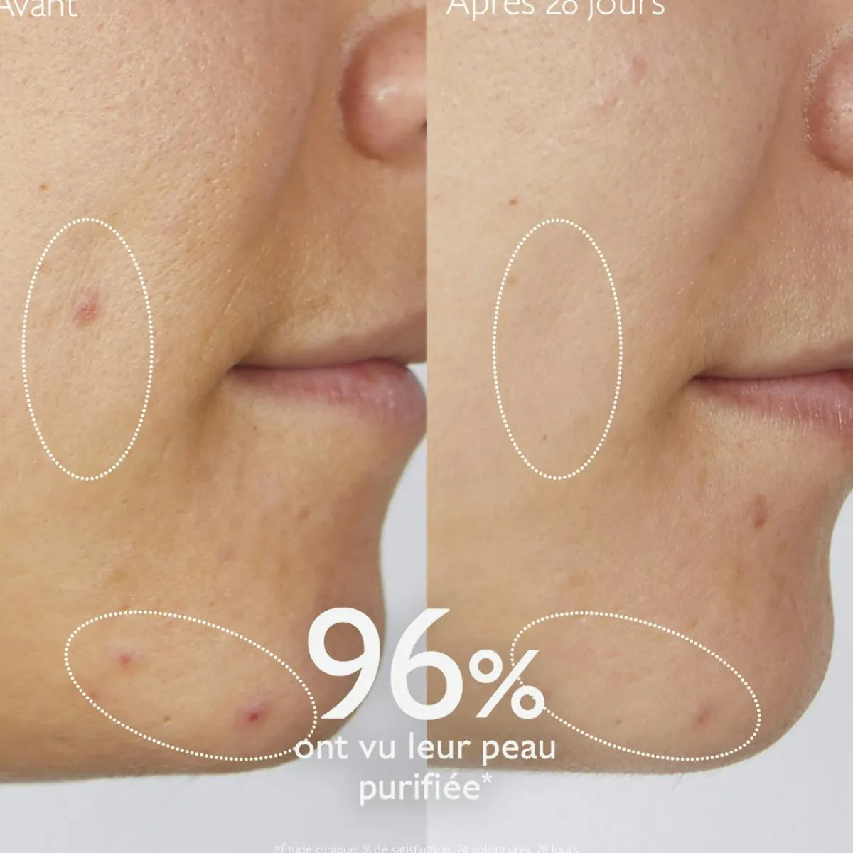 CAUDALIE Peaux À Tendance Acnéique|Démaquillants & Nettoyants^Gelée Nettoyante à l'Acide Salicylique Purifiante - 150mL