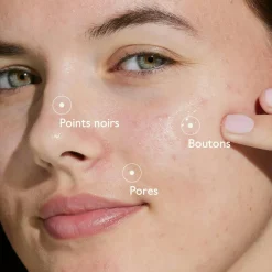 CAUDALIE Sérums|Peaux À Tendance Acnéique^Routine Anti-Imperfections à l'Acide Salicylique