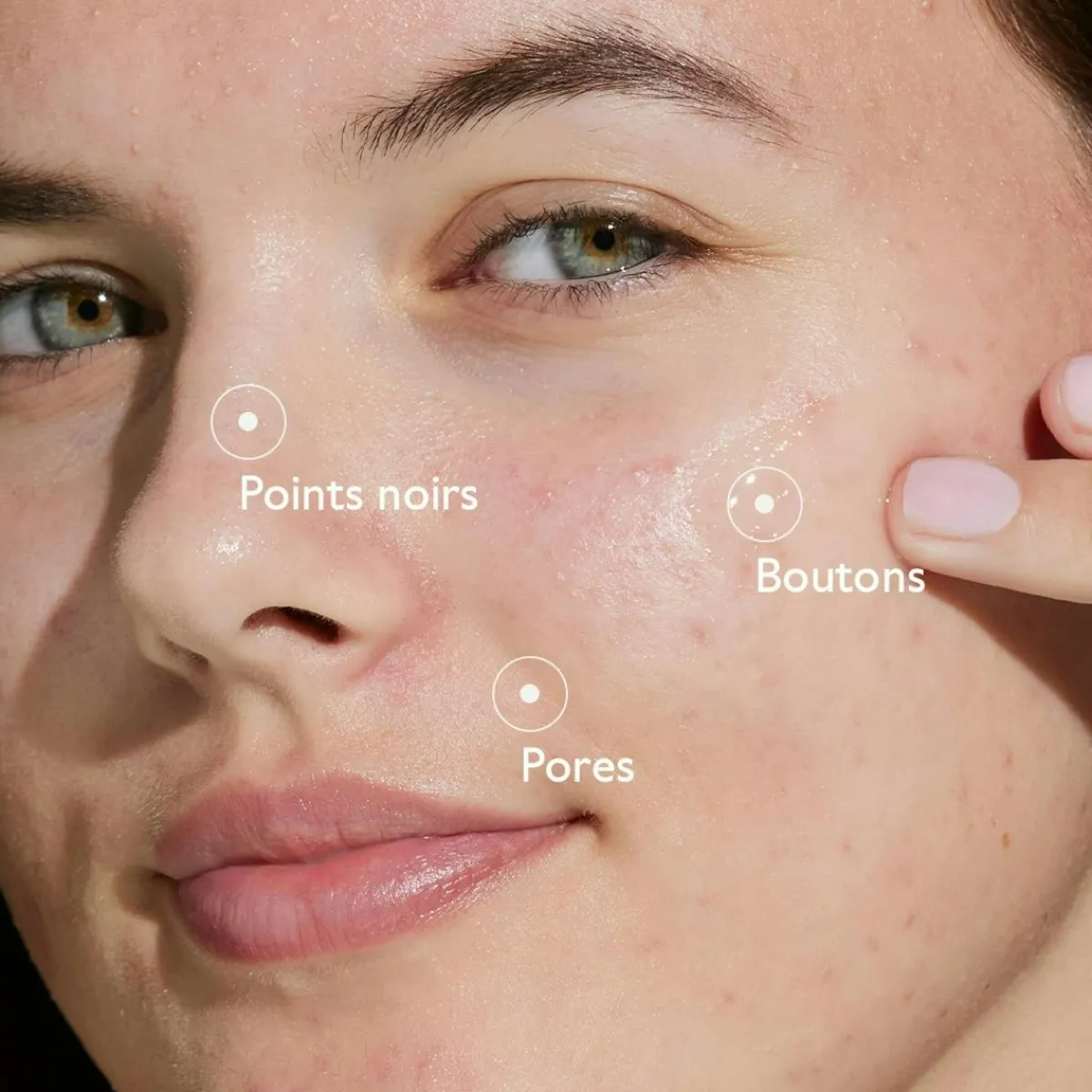 CAUDALIE Sérums|Peaux À Tendance Acnéique^Routine Anti-Imperfections à l'Acide Salicylique