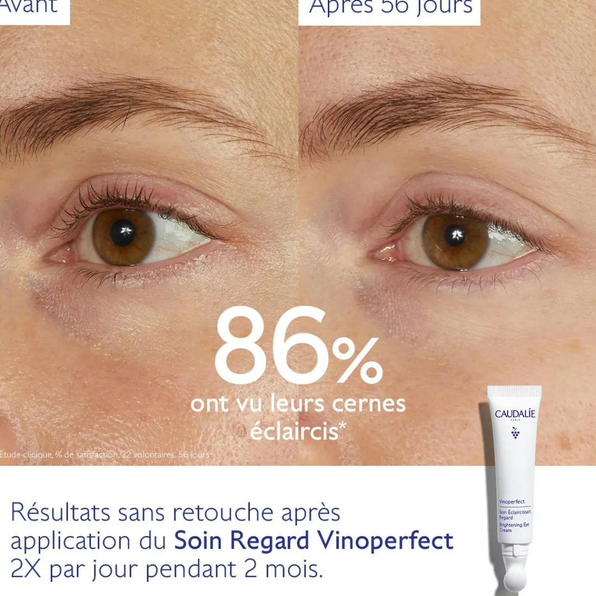 CAUDALIE Anti-Cernes, Poches|Éclat, Anti-Taches^Soin Éclaircissant Regard Anti-Cernes à la Caféine et Niacinamide