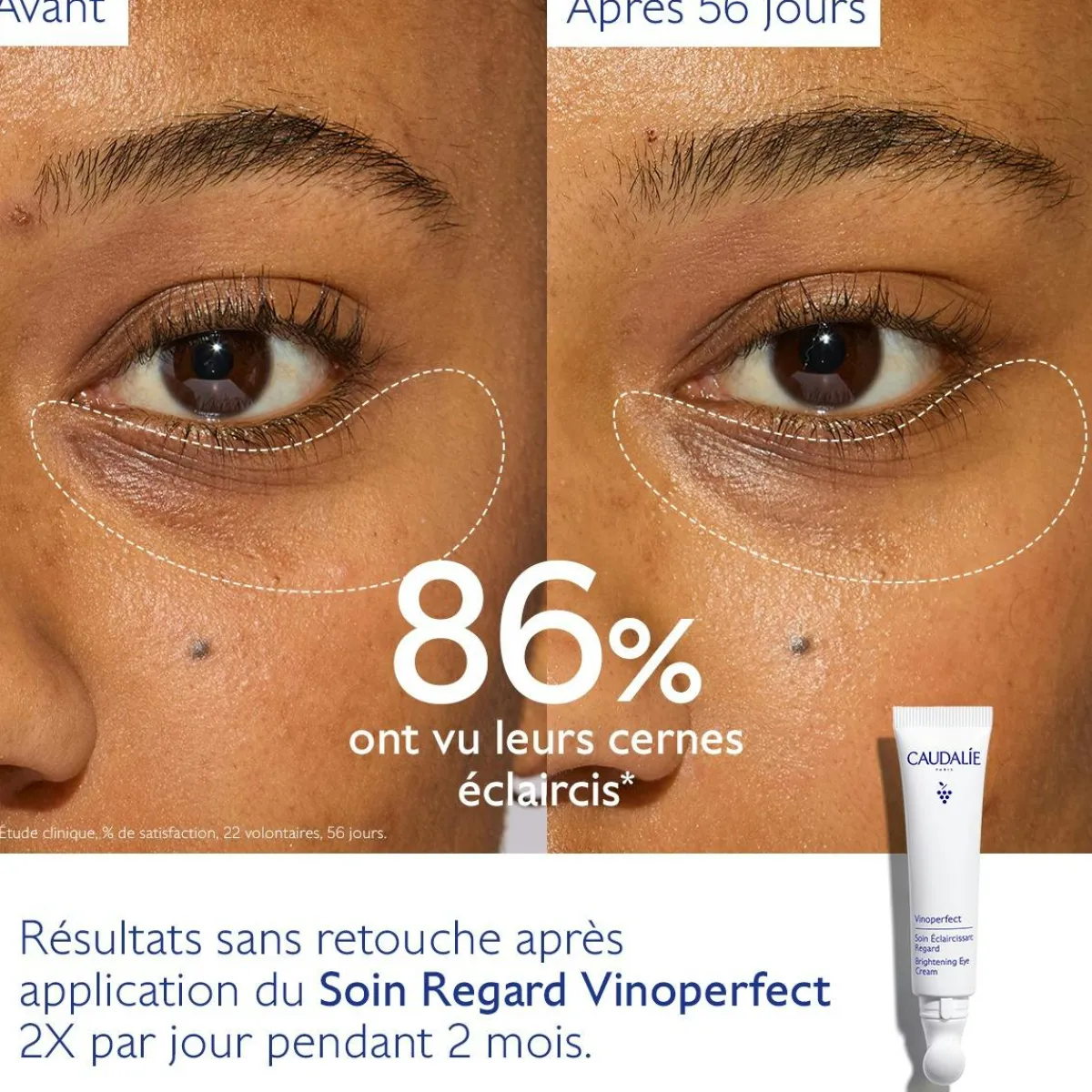CAUDALIE Anti-Cernes, Poches|Éclat, Anti-Taches^Soin Éclaircissant Regard Anti-Cernes à la Caféine et Niacinamide