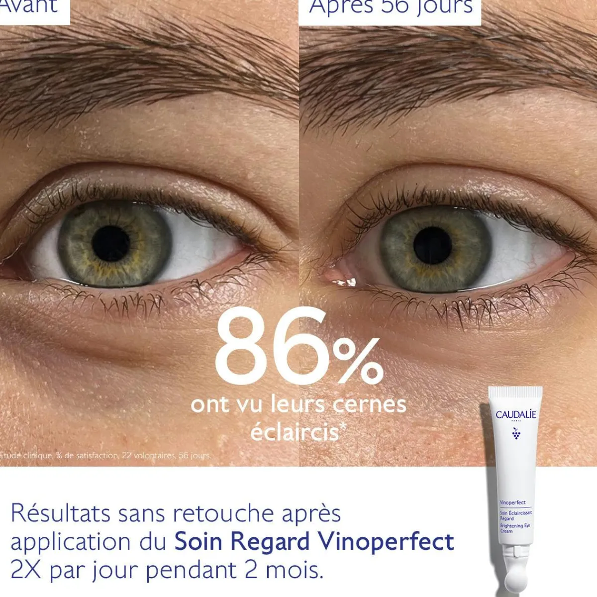 CAUDALIE Anti-Cernes, Poches|Éclat, Anti-Taches^Soin Éclaircissant Regard Anti-Cernes à la Caféine et Niacinamide