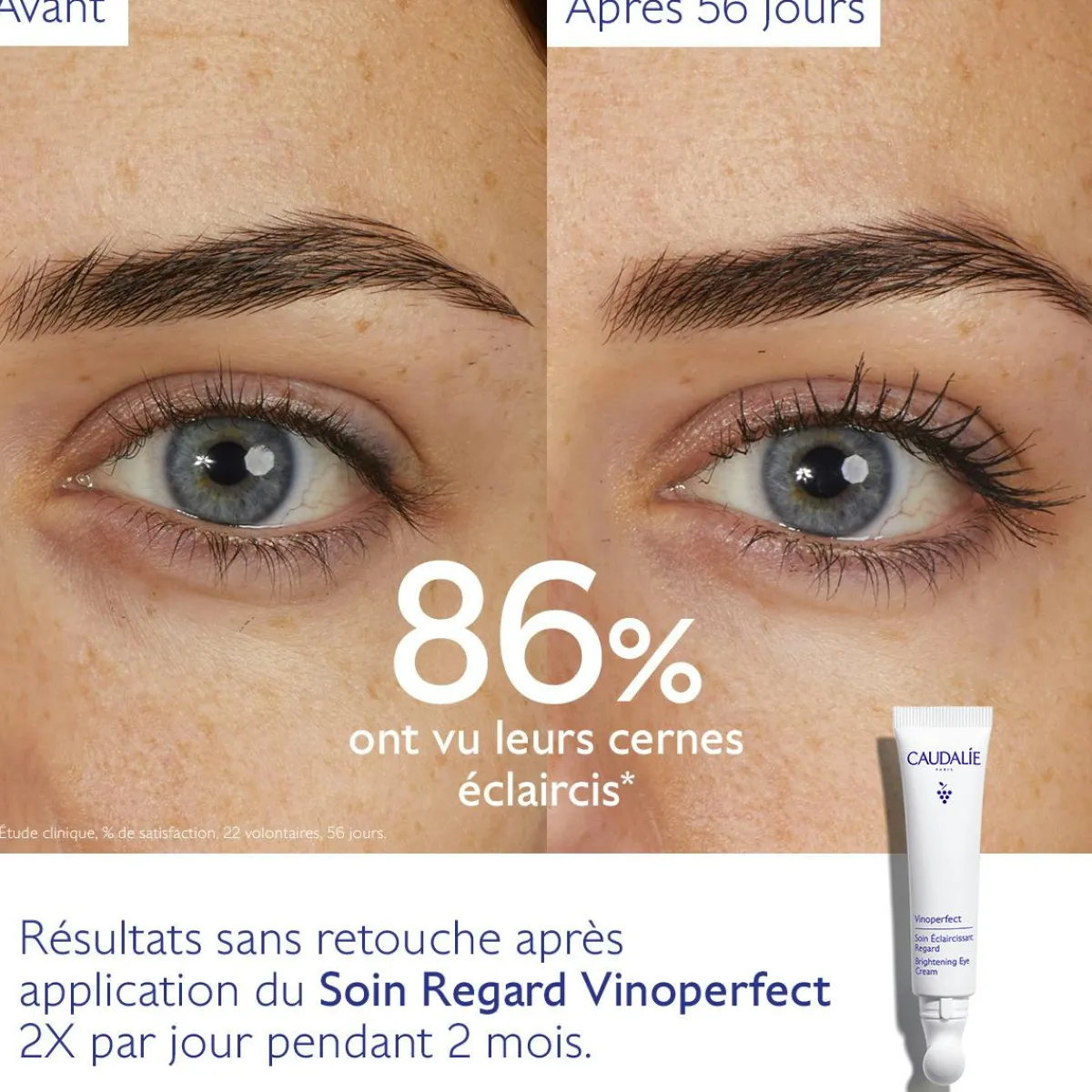 CAUDALIE Anti-Cernes, Poches|Éclat, Anti-Taches^Soin Éclaircissant Regard Anti-Cernes à la Caféine et Niacinamide