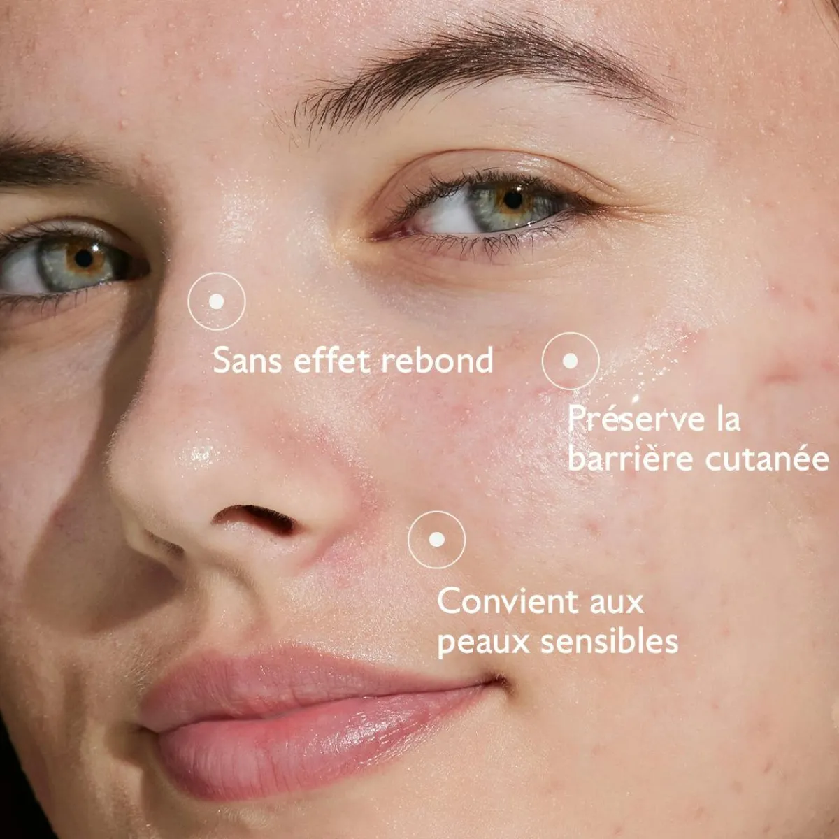 CAUDALIE Peaux À Tendance Acnéique|Sérums^Sérum à l'Acide Salicylique Anti-imperfections