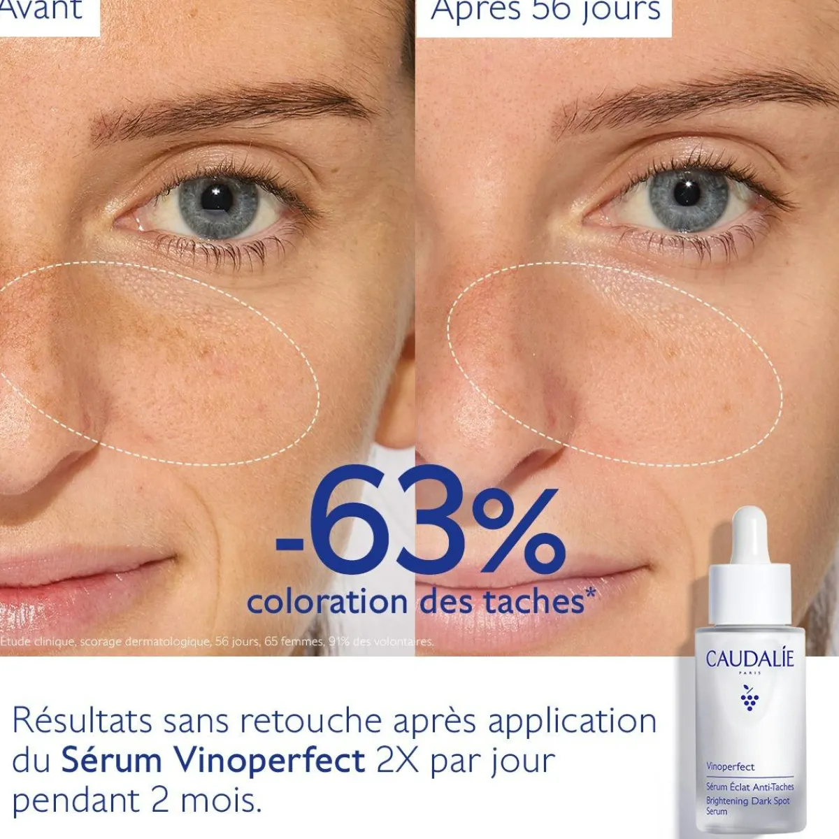 CAUDALIE Sérums|Éclat, Anti-Taches^Sérum Éclat Anti-Taches à la Viniférine, alternative à la Vitamine C - 30ml