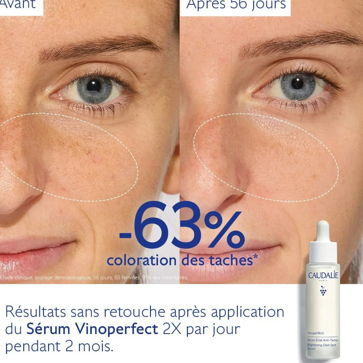 CAUDALIE Éclat, Anti-Taches|Sérums^Sérum Éclat Anti-Taches à la Viniférine, alternative à la Vitamine C - Grand Format