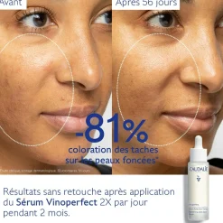 CAUDALIE Éclat, Anti-Taches|Sérums^Sérum Éclat Anti-Taches à la Viniférine, alternative à la Vitamine C - Grand Format