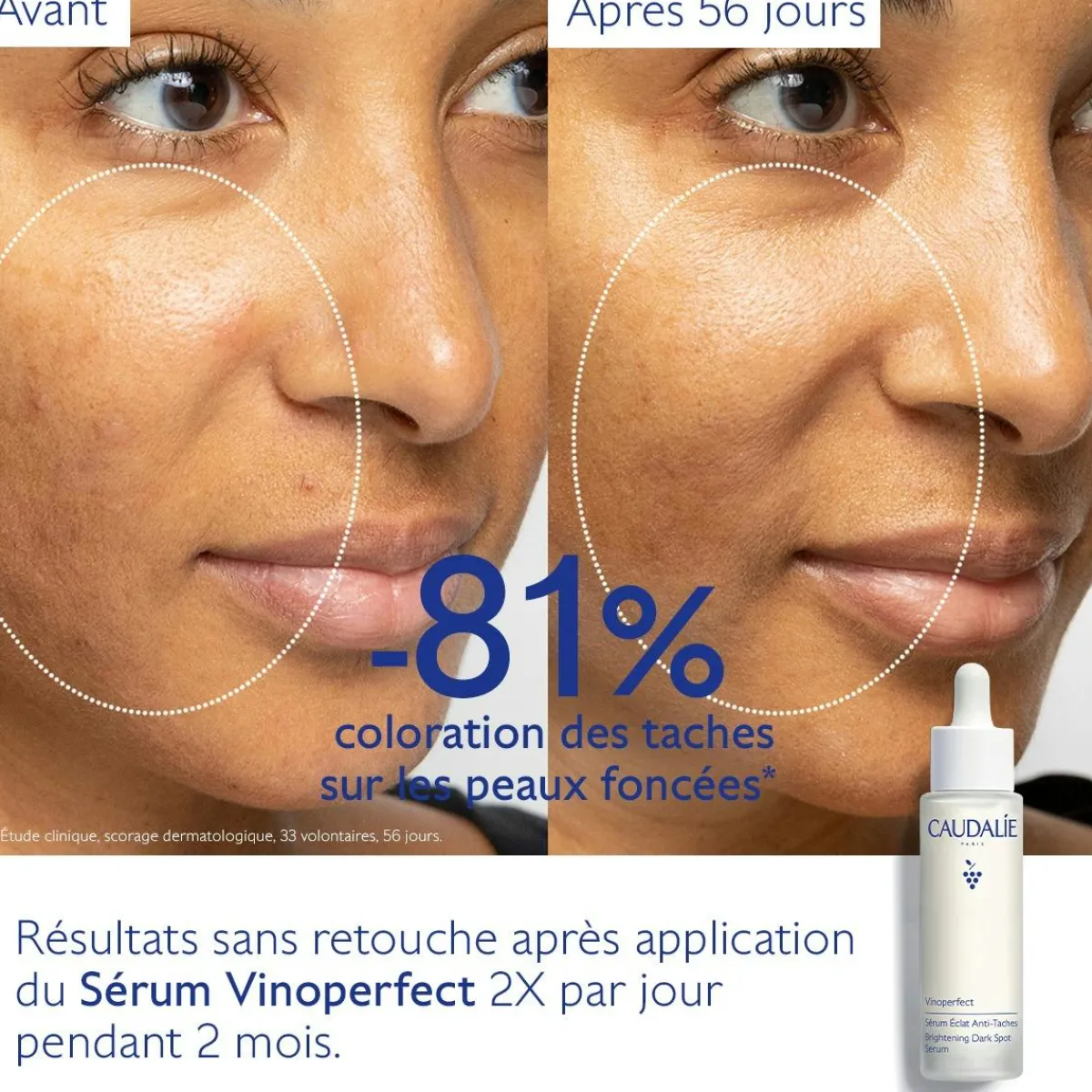 CAUDALIE Éclat, Anti-Taches|Sérums^Sérum Éclat Anti-Taches à la Viniférine, alternative à la Vitamine C - Grand Format