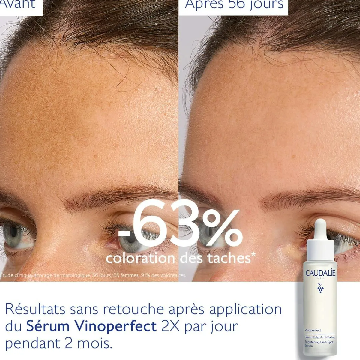 CAUDALIE Éclat, Anti-Taches|Sérums^Sérum Éclat Anti-Taches à la Viniférine, alternative à la Vitamine C - Grand Format